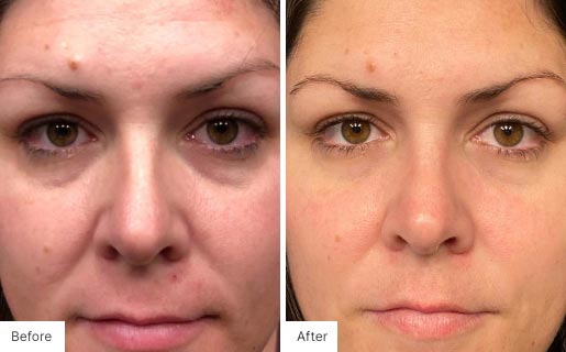 8 - Before and After Real Results image for Age IQ Night Cream