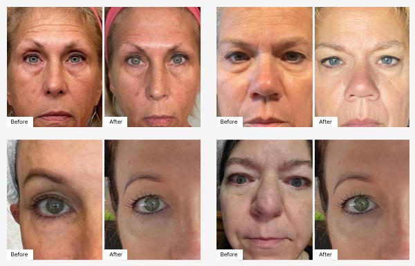 Images of actual customers' Before & After photos displaying their Real Results with SIG-1723.